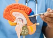 Layanan Pemeriksaan Dokter Spesialis Saraf RSUD Pandega Pangandaran