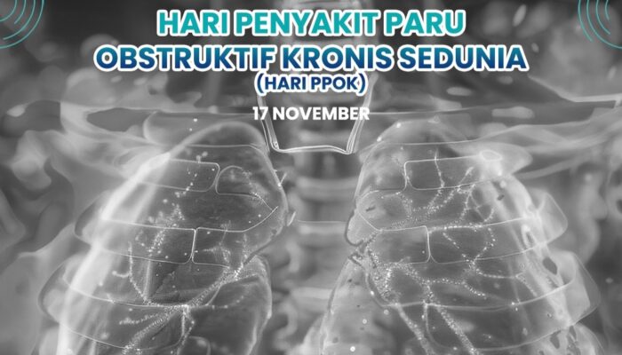 RSUD Pandega Pangandaran Peringati Hari Penyakit Paru Obstruktif Kronik