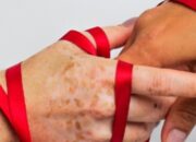 RSUD Pandega Pangandaran Bagikan Informasi: Fakta Penularan HIV/AIDS yang Perlu Diketahui