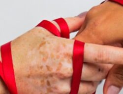 RSUD Pandega Pangandaran Bagikan Informasi: Fakta Penularan HIV/AIDS yang Perlu Diketahui