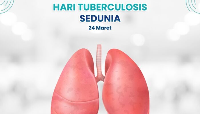 RSUD Pandega Pangandaran Perkuat Deteksi Dini untuk Tekan Kasus Tuberkulosis